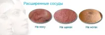 дерматології