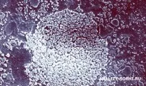 Бактеріологічний посів на мікоплазму (Mycoplasma hominis) у лабораторії Оптимум г посів