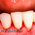 яєчках