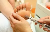 Болить мозоль причини дискомфорту та методи лікування мозоль