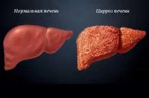 печінки