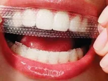 Crest Whitestrips огляд смужок для відбілювання зубів, відгуки про них crest