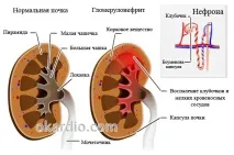 причини