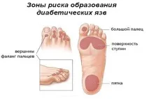 цукровому