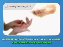 Як позбудеться мозолів на ногах, руках, п’ятах, підошві і зупинити ріст кісточки ногах