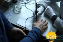 Лікування від паразитів гомеопатією у центрі - Адоніс паразитів