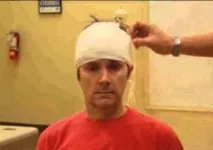 Лікування гематоми на голові після забиття у дитини та дорослої дитини