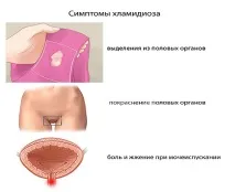 Лікування хламідіозу лікування