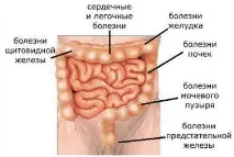 Очищення кишечника - очищення кишечника вдома в домашніх умовах умовах