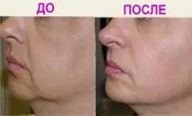 Омолоджуючі маски для обличчя в домашніх умовах як перемогти старість самотужки маски