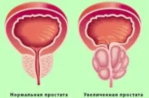 Палін та алкоголь сумісність та наслідки алкоголь