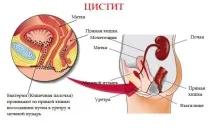 Палін та алкоголь сумісність та наслідки сумісність