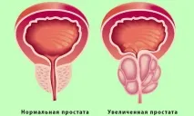 Палін та алкоголь сумісність та наслідки наслідки