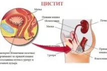 Палін та алкоголь сумісність та наслідки Палін