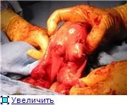 українські гінекологи приховують правду - Медицина 2 приховують