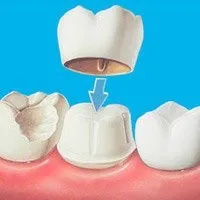 Стоматологія - Biodental стоматологія