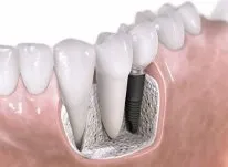 Стоматологія - Biodental стоматологія