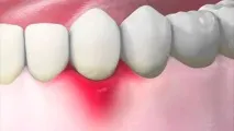 Стоматологія - Biodental стоматологія