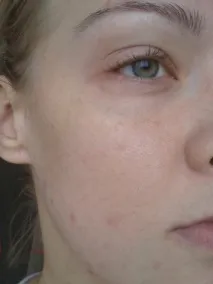 Який тональний засіб вибрати – споконвічне питання споконвічне