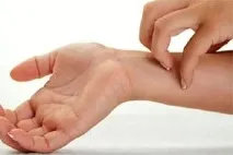 Укус мурашки симптоми, лікування, народні засоби, яка користь - My Life укус