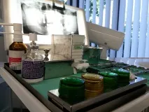 Видалення зуба мудрості при вагітності показання для видалення мудрості