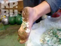 Вставши босий, з гирями, на скло, кузбаський хлопець позбувся діагнозу «параліч» босий