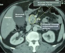 розшифровка