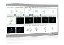 CytoVision