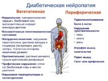 Діабетична нейропатія симптоми та лікування, що це таке нейропатія