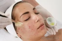 Гід за кислотами, корисними для шкіри кислотами