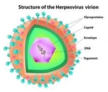 herpesului