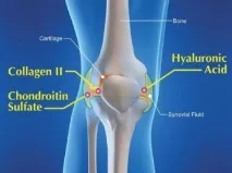 Glucosamine Chondroitin MSM як приймати Лікування суглобів за допомогою препаратів з глюкозаміном та glucosamine