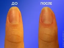 Як робити апаратний манікюр вдома, косметика та краса манікюр