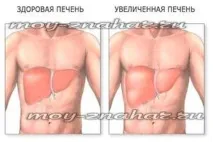Який алкоголь менш шкідливий для печінки шкідливий