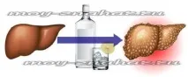 Який алкоголь менш шкідливий для печінки алкоголь