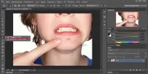 Як прибрати прищі у фотошопі з Допомога Штампа допомога