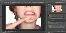 Як прибрати прищі у фотошопі з Допомога Штампа штампа