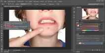 Як прибрати прищі у фотошопі з Допомога Штампа прибрати