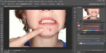 Як прибрати прищі у фотошопі з Допомога Штампа фотошопі