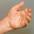 ласка