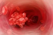 Променева хвороба – причини та симптоми, ступеня та форми променевої хвороби, діагностика, лікування та причини