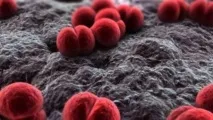 Менінгококовий менінгіт та менінгококова інфекція у дітей інфекція