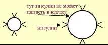 Чи можна вилікувати діабет вилікувати