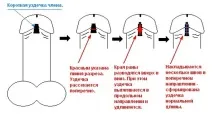 плоті