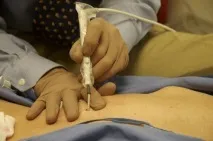 родимки