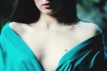 родимки