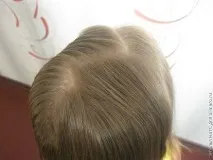 Зачіска Лотос для дівчинки, про волосся лотос