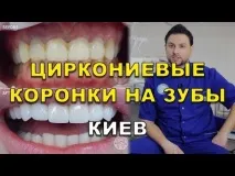 Протезування зубів Київ ціна 2019 року види протези ЛюміДент, Все найкраще стоматологічне лікування київ