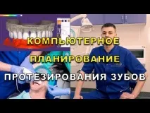 Протезування зубів Київ ціна 2019 року види протези ЛюміДент, Все найкраще стоматологічне лікування зубів