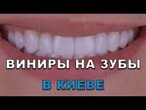 Протезування зубів Київ ціна 2019 року види протези ЛюміДент, Все найкраще стоматологічне лікування київ